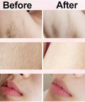 Electric Shaver for Woman Female Razor Body Epilator Face Facial Mustache Leg Body Underarm Bikini Electric Hair Remover Trimmer
